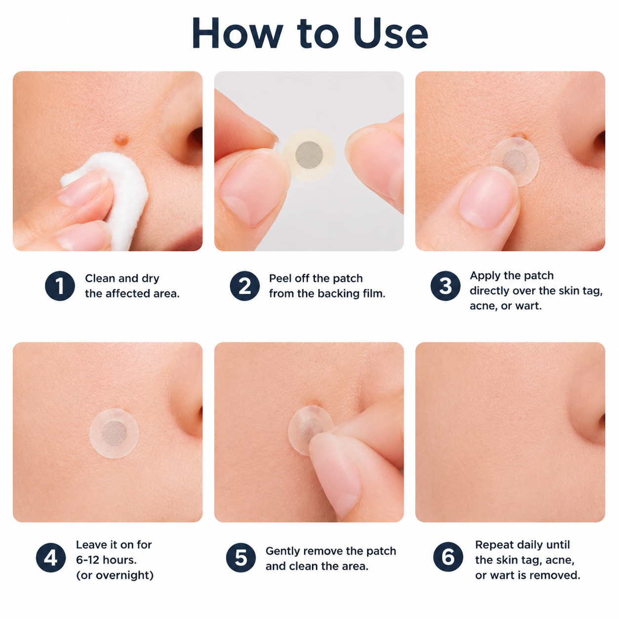 🧑‍⚕️PuraCure® 2-in-1 Microneedle & Hydrocolloid Patch🍀| Removes Raised Moles, Acne, Flat Warts & Skin Tags | Helps Improve Wrinkles, Scars & Blemishes | Invisible Patches for Face & Body