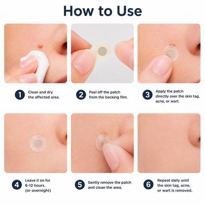 🧑‍⚕️PuraCure® 2-in-1 Microneedle & Hydrocolloid Patch🍀| Removes Raised Moles, Acne, Flat Warts & Skin Tags | Helps Improve Wrinkles, Scars & Blemishes | Invisible Patches for Face & Body
