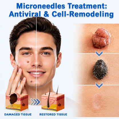 🧑‍⚕️PuraCure® 2-in-1 Microneedle & Hydrocolloid Patch🍀| Removes Raised Moles, Acne, Flat Warts & Skin Tags | Helps Improve Wrinkles, Scars & Blemishes | Invisible Patches for Face & Body